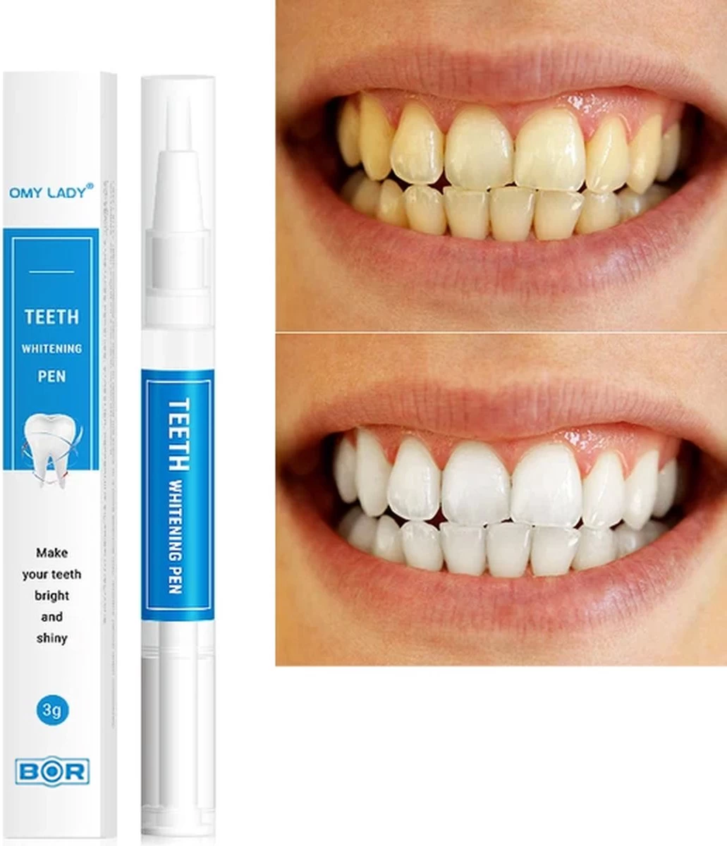 BOR Tanden Bleekpen - Tanden Bleken - Tandenbleekset - Whitening Pen - Tandenblekers - Wittere Tanden - Teeth Whitening Pen - Tanden Bleker - Afbeelding 3
