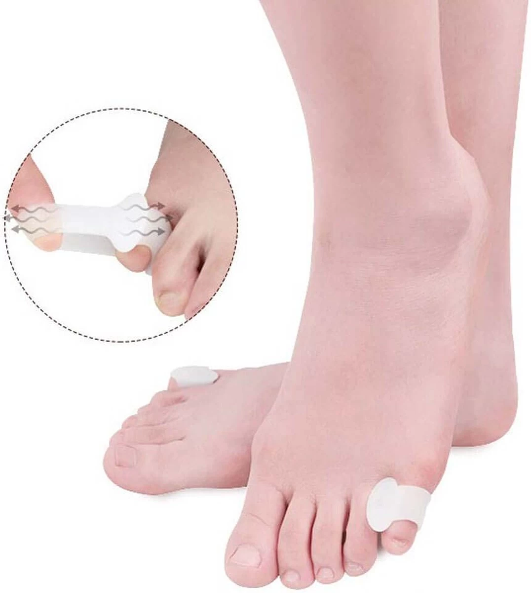 Solelution Kleine Teenspreider - Teencorrector - Per Paar - Afbeelding 2