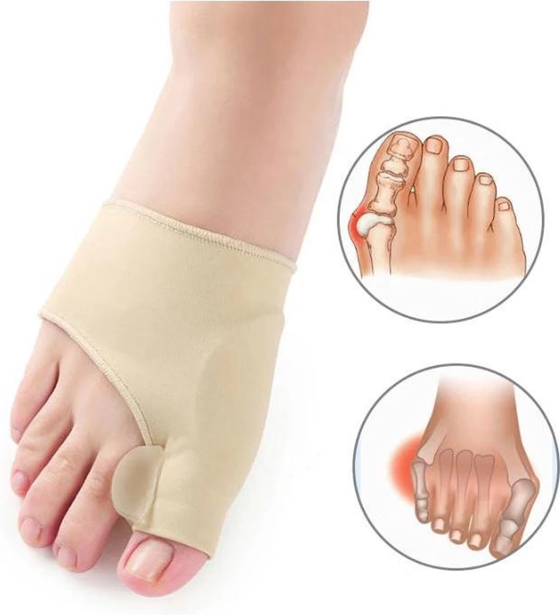 Merkloos Hallux Valgus Teen Spreider/Corrector Knobbel Teen Corrector |bunion | Eeltknobbel | Teen Rechtzetten | Comfortabel