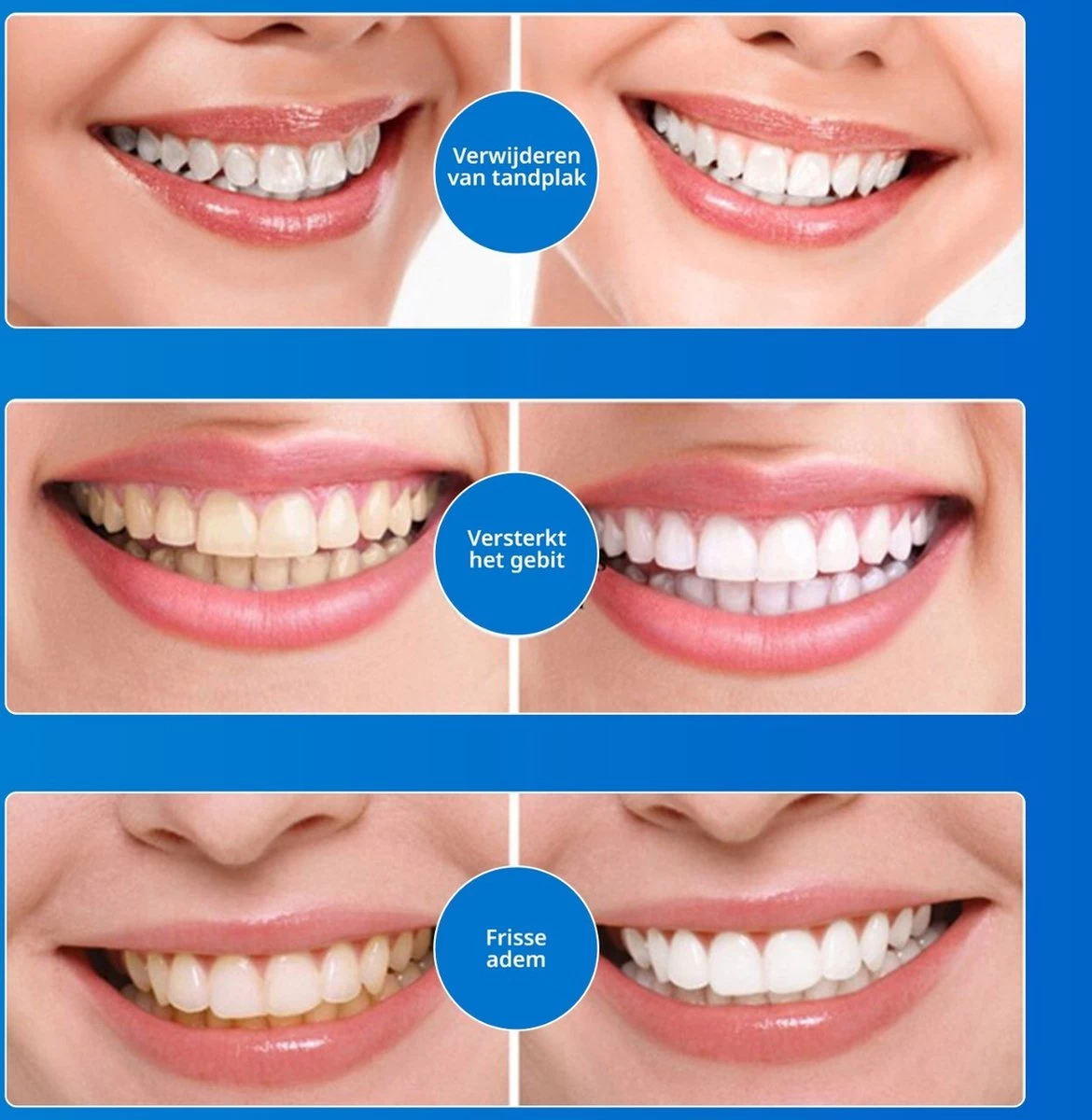 B-care Tanden Bleekpen - Teeth Whitening Pen - Tanden Bleker - Wittere Tanden - Teeth Whitening Strips - Professioneel Resultaat - Tandsteen Verwijderaar - Zonder Peroxide - Tandenbleekset - Tanden Bleken - Afbeelding 8