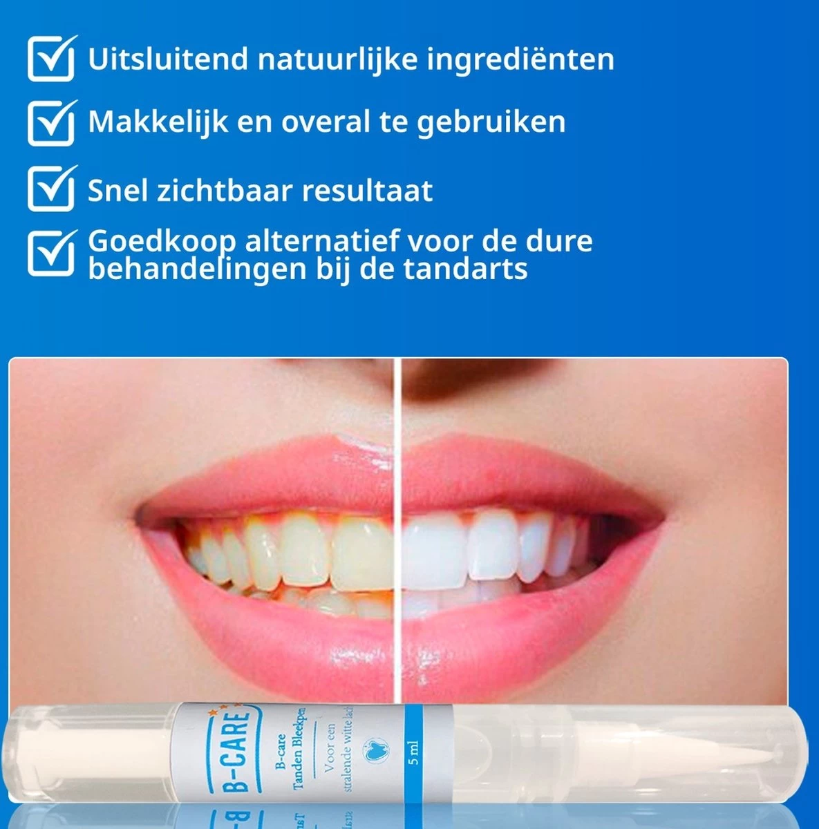 B-care Tanden Bleekpen - Teeth Whitening Pen - Tanden Bleker - Wittere Tanden - Teeth Whitening Strips - Professioneel Resultaat - Tandsteen Verwijderaar - Zonder Peroxide - Tandenbleekset - Tanden Bleken - Afbeelding 5