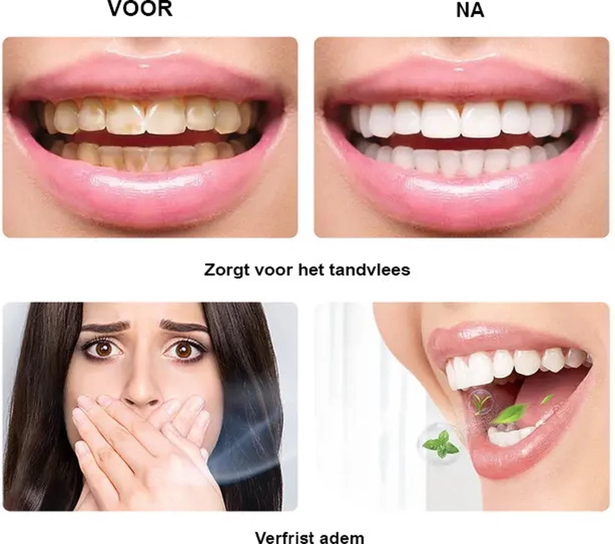 BOR Tanden Bleekpen - Tanden Bleken - Tandenbleekset - Whitening Pen - Tandenblekers - Wittere Tanden - Teeth Whitening Pen - Tanden Bleker - Afbeelding 4