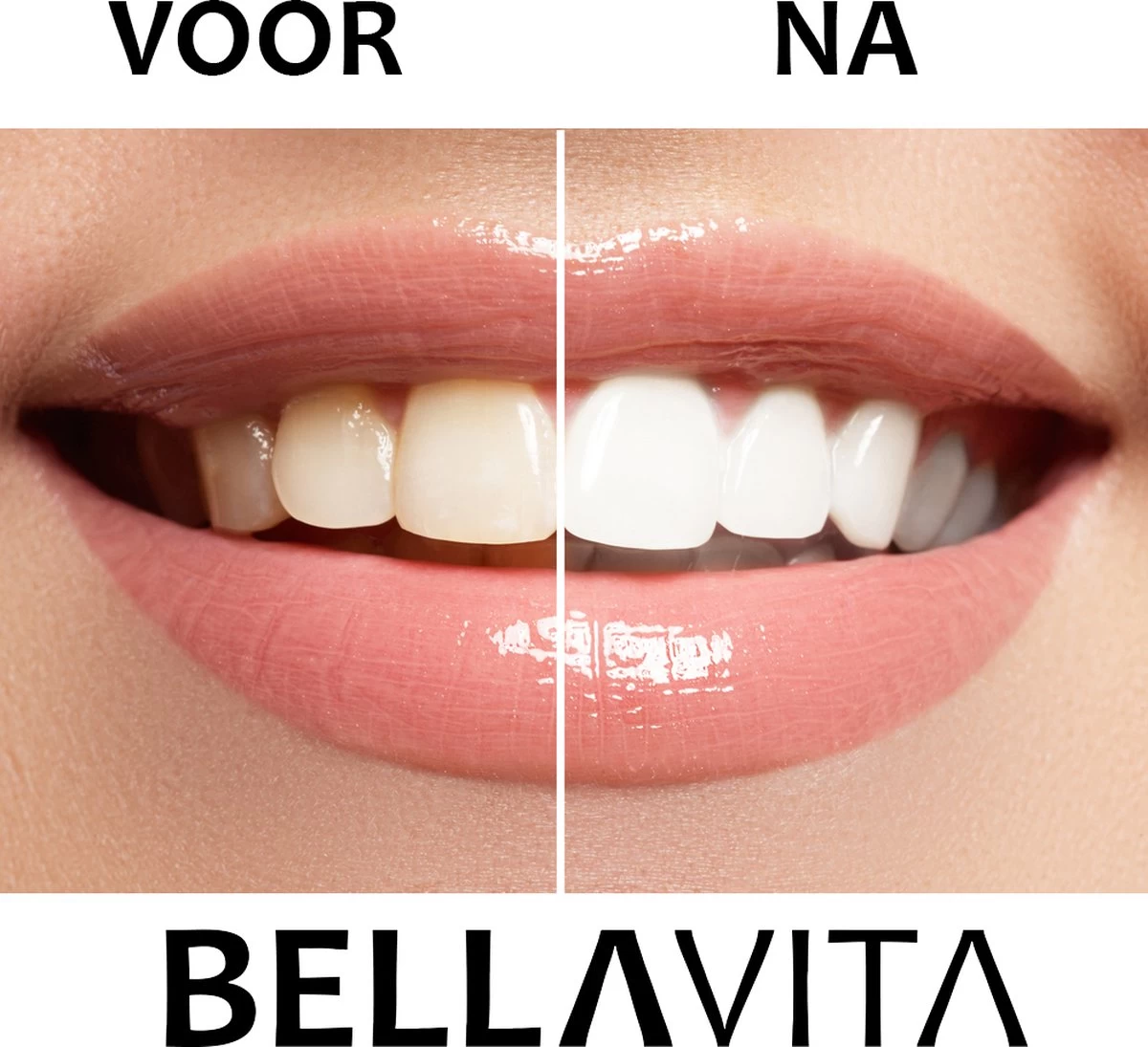 BELLAVITA Tandenbleekset - Tanden Bleken - Teeth Whitening Kit - Tandenblekers - 4 Gelpennen - Zonder Peroxide - 100% Natuurlijk - Witte Tanden - Afbeelding 7