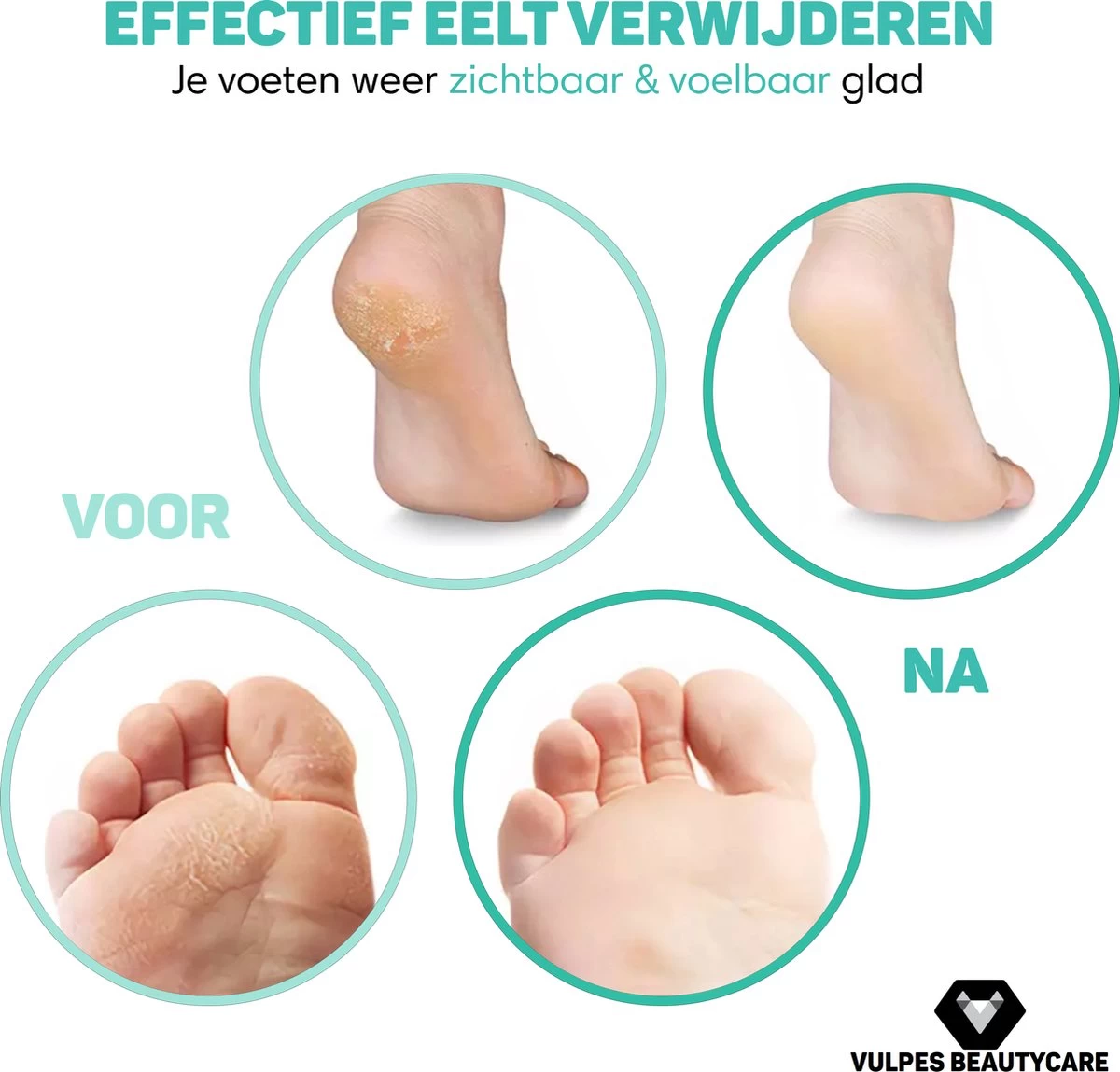 Vulpes BeautyCare® Elektrische Eelt Verwijderaar Pro – Stofzuigfunctie – 3 Snelheden – Inclusief 3 Vijlschijven & Borstel - USB-Oplaadbaar - Afbeelding 2