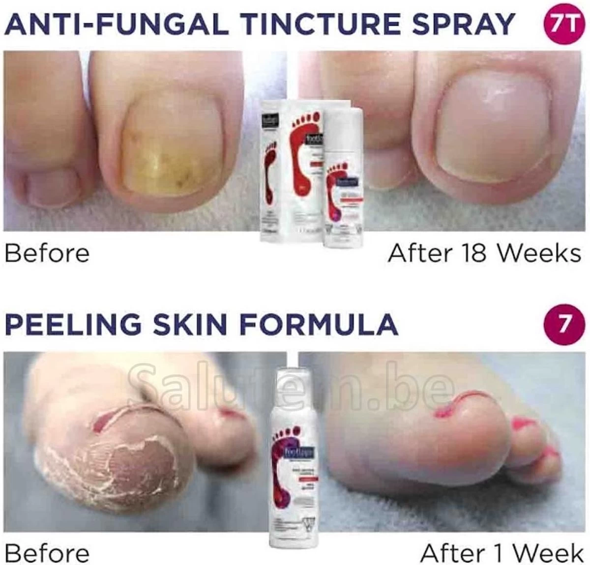 Footlogix Toe Nail Tincture Nagelspray - Afbeelding 3