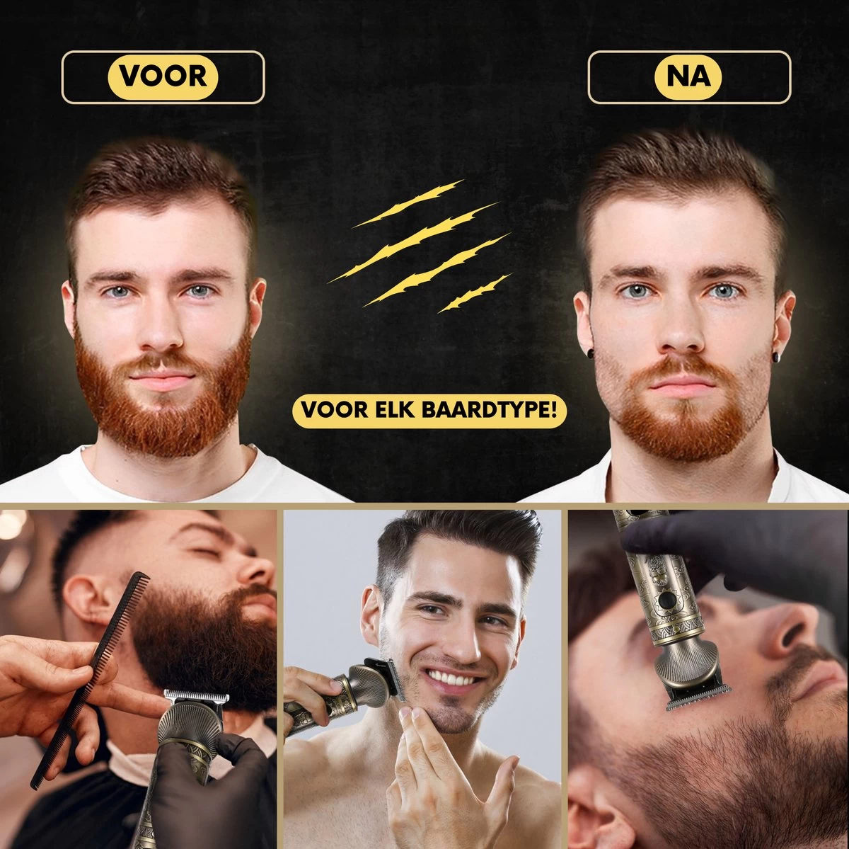 6-in-1 Baardtrimmer Mannen - Trimmer Voor Baard En Lichaam - Incl. 6 Opzetstukken - Bodygroomer Mannen - Bodytrimmer Heren - Tondeuse - 0.5-15MM - Neus En Oor - Afbeelding 12