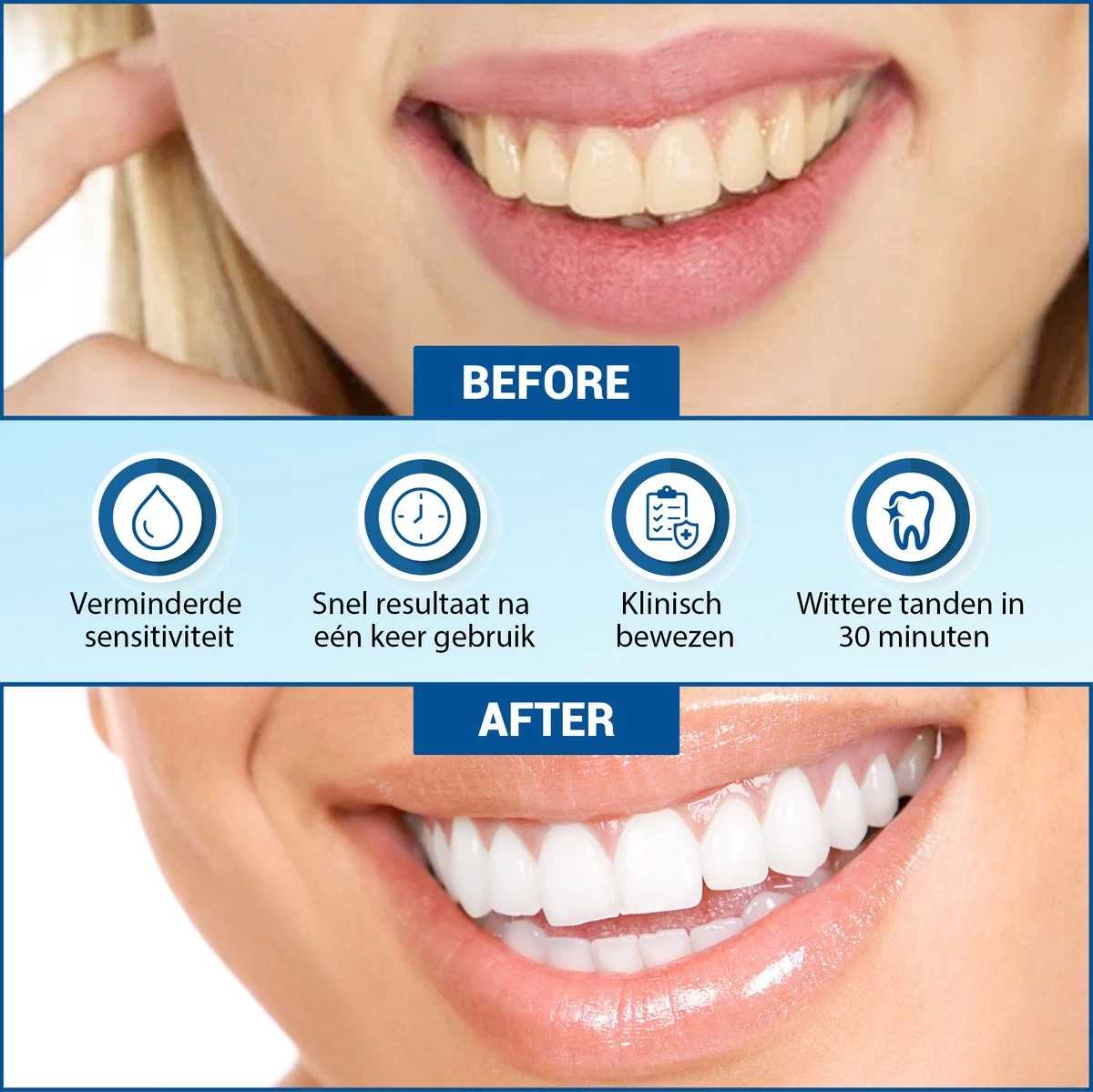 V-Goods Premium Whitening Strips - Tandenbleek Strips - Wittere Tanden - 28x Tandenbleek Strips DIRECT Resultaat - Tandenbleekset - Whitening - Tandenblekers - Afbeelding 4