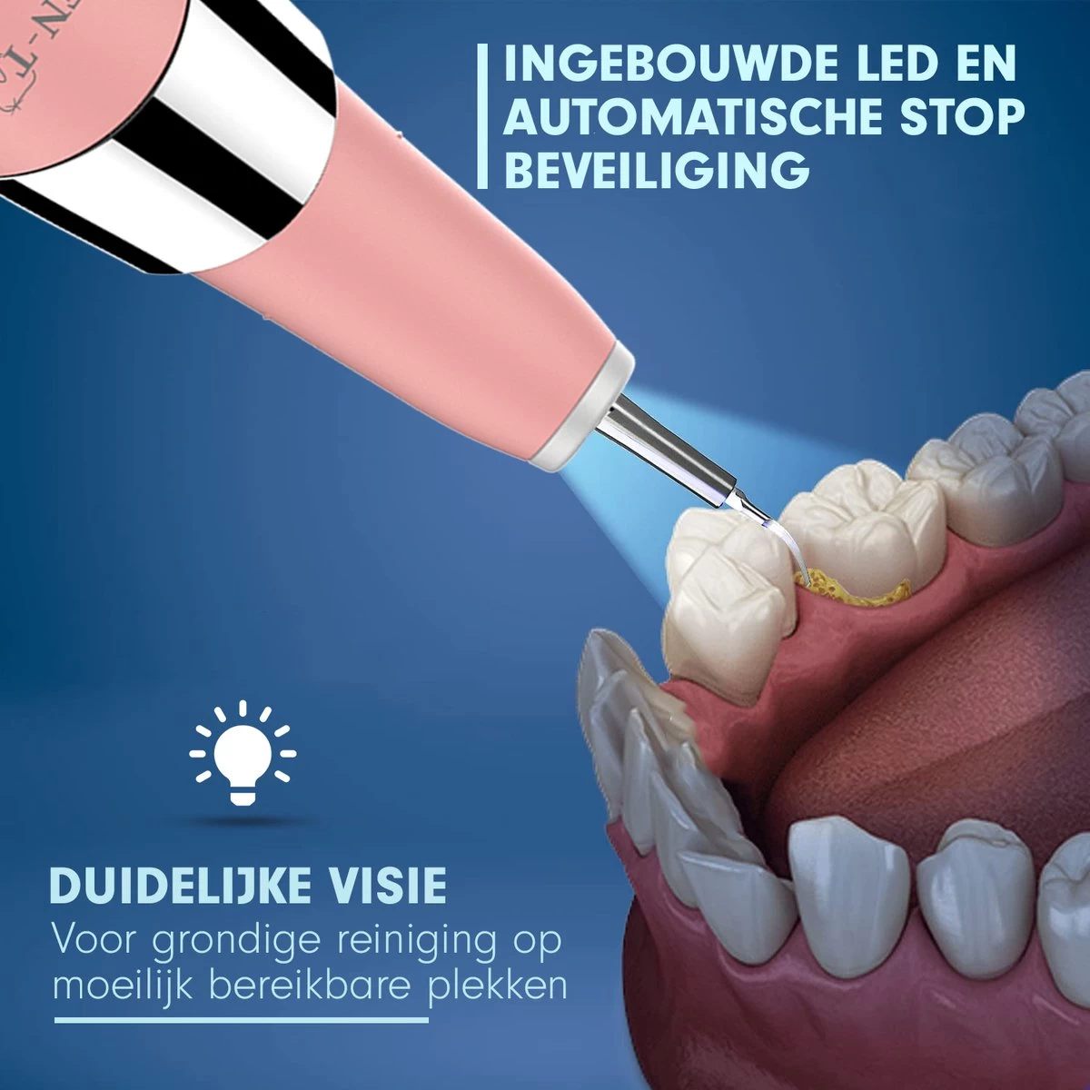 DEN-T® PRO U500 - Elektrische Sonische Tandsteen Verwijderaar - Roze - Afbeelding 3