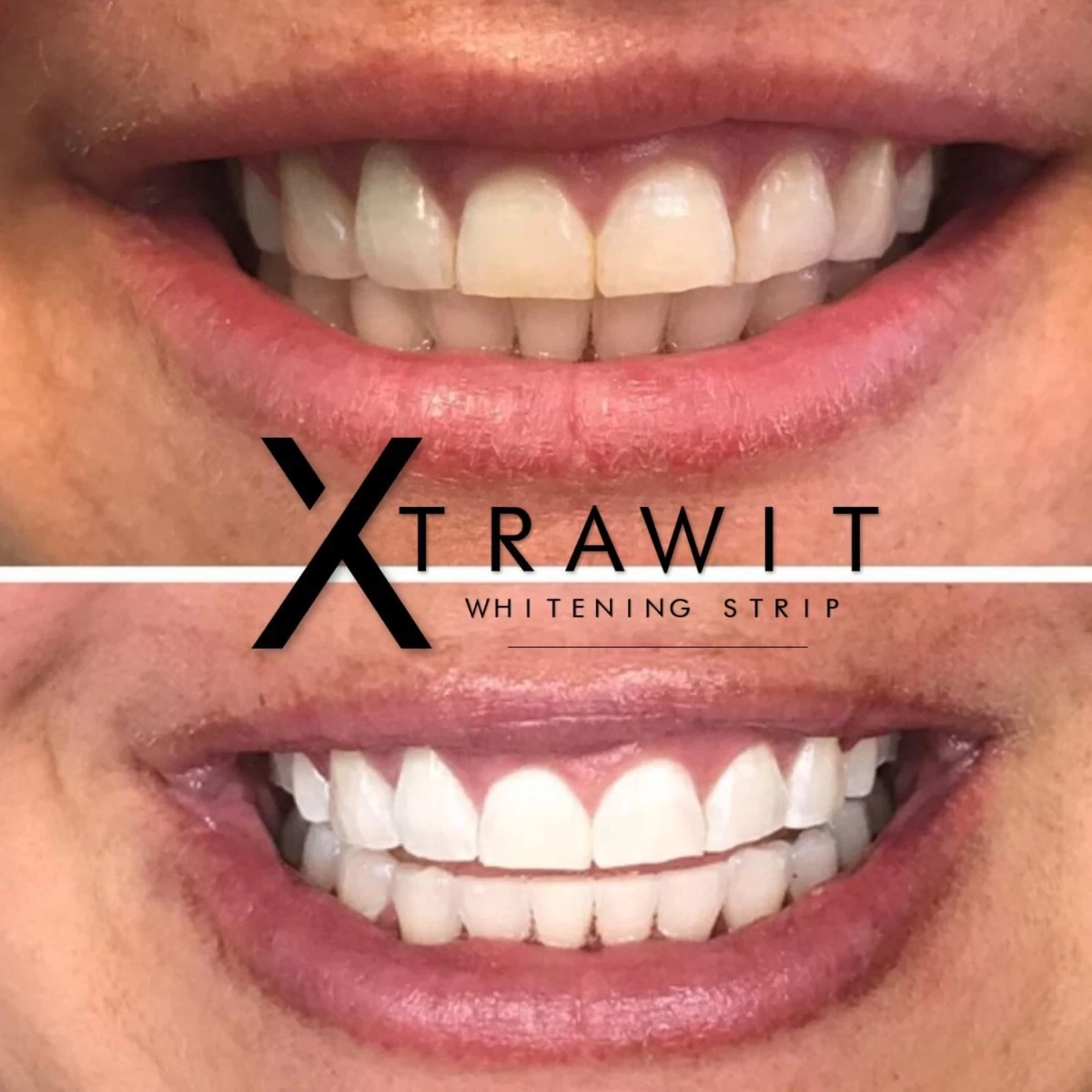 Xtrawit - Teeth Whitening Strips - Tandenbleekset - Wittere Tanden - Goedgekeurde Tandenbleek Strips - 30 Strips - Afbeelding 5