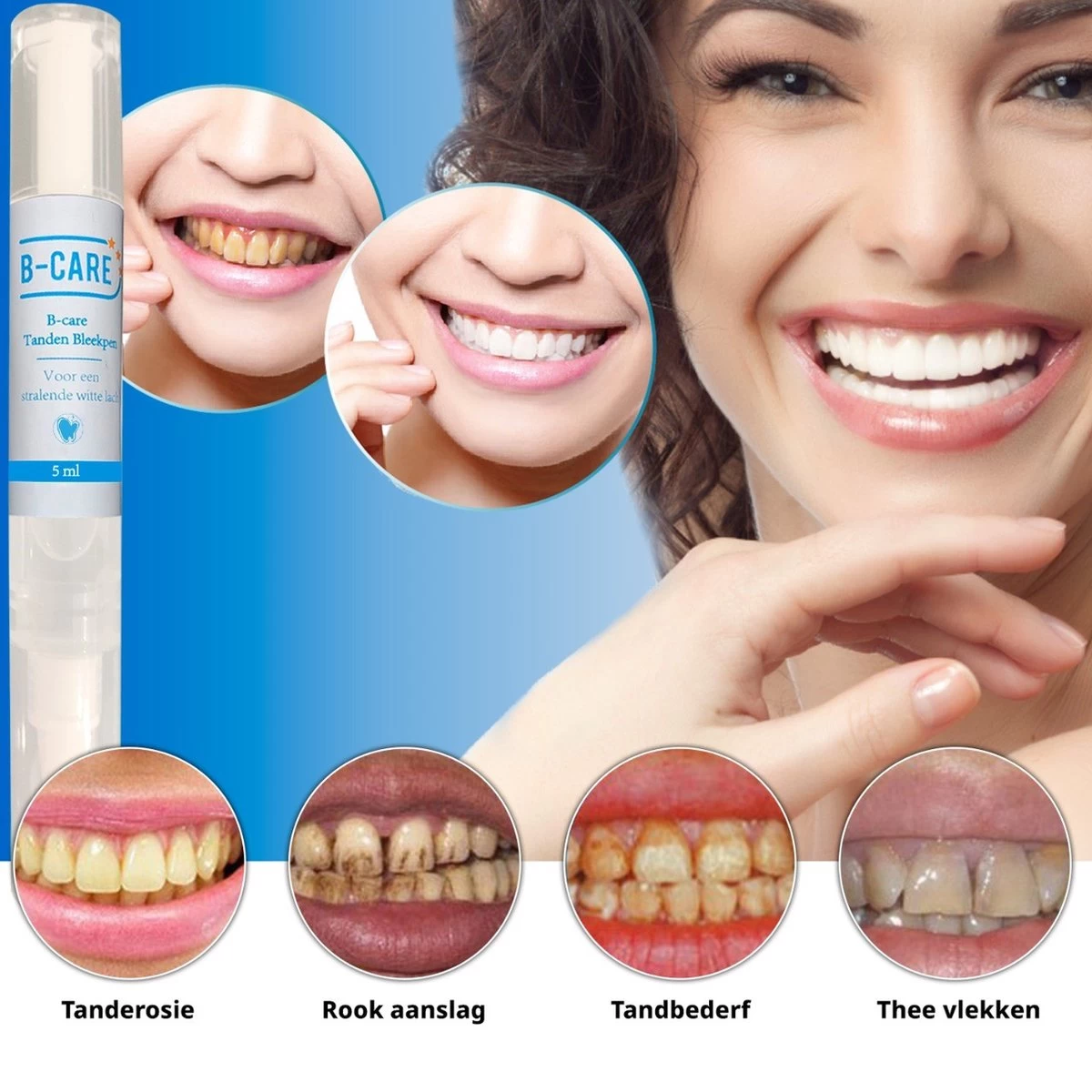 B-care Tanden Bleekpen - Teeth Whitening Pen - Tanden Bleker - Wittere Tanden - Teeth Whitening Strips - Professioneel Resultaat - Tandsteen Verwijderaar - Zonder Peroxide - Tandenbleekset - Tanden Bleken - Afbeelding 7