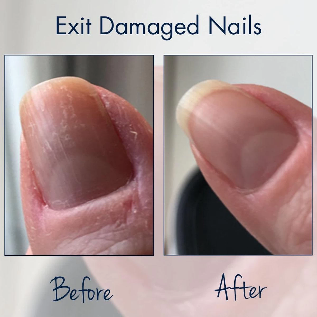 Herome Exit Damaged Nails Nagelolie – Amandelolie Met Vitamines En Mineralen Verbetert En Herstelt De Nagels - 7 Ml. - Afbeelding 2