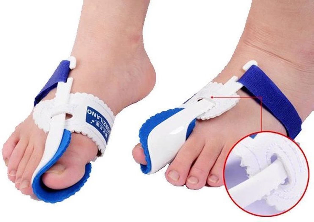 Hallux Valgus Statische Nachtspalk - Rechts + Links - Foot Pijnbestrijding - Teen Separator - Duim Corrector - Blauw / Wit - Afbeelding 3