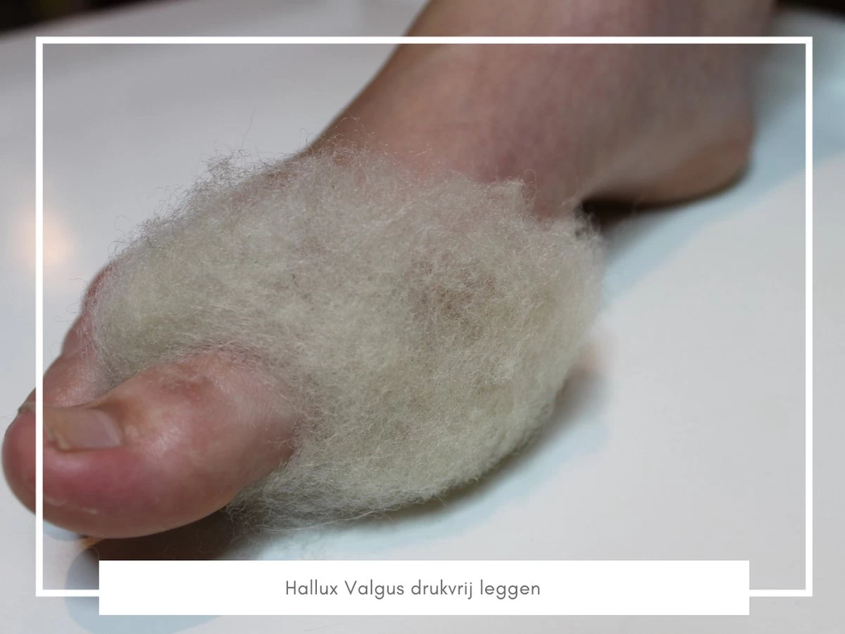 Merkloos WandelWol 10 Gram - De Oplossing Bij Blaren En Voet Ongemak - Antidruk & Antiblaar - Afbeelding 2