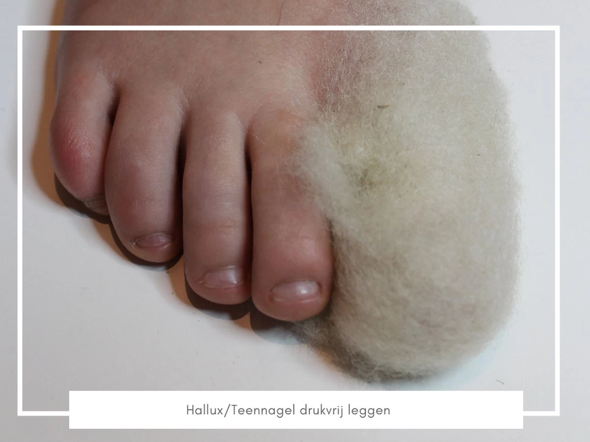 Merkloos WandelWol 10 Gram - De Oplossing Bij Blaren En Voet Ongemak - Antidruk & Antiblaar - Afbeelding 4