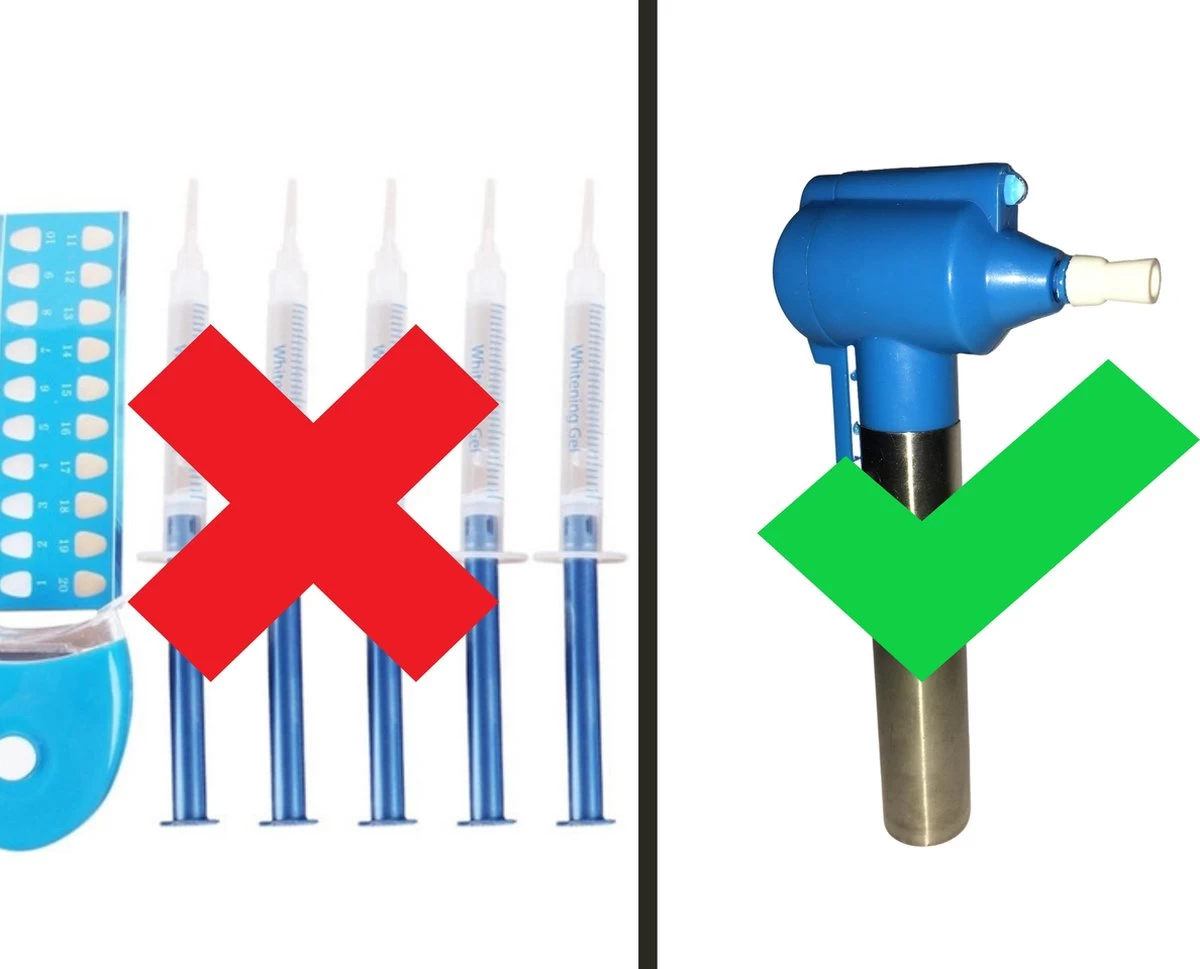 Merkloos HQ Tooth Polisher - Tanden Polijsten - Wittere Tanden - Tandsteen Tandplak Verwijderaar - Elektrisch - Afbeelding 4