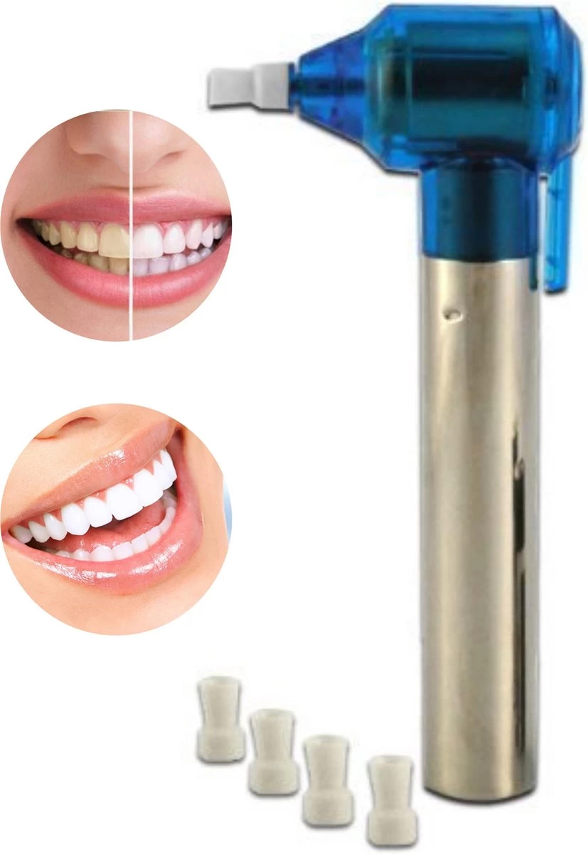 Merkloos HQ Tooth Polisher - Tanden Polijsten - Wittere Tanden - Tandsteen Tandplak Verwijderaar - Elektrisch