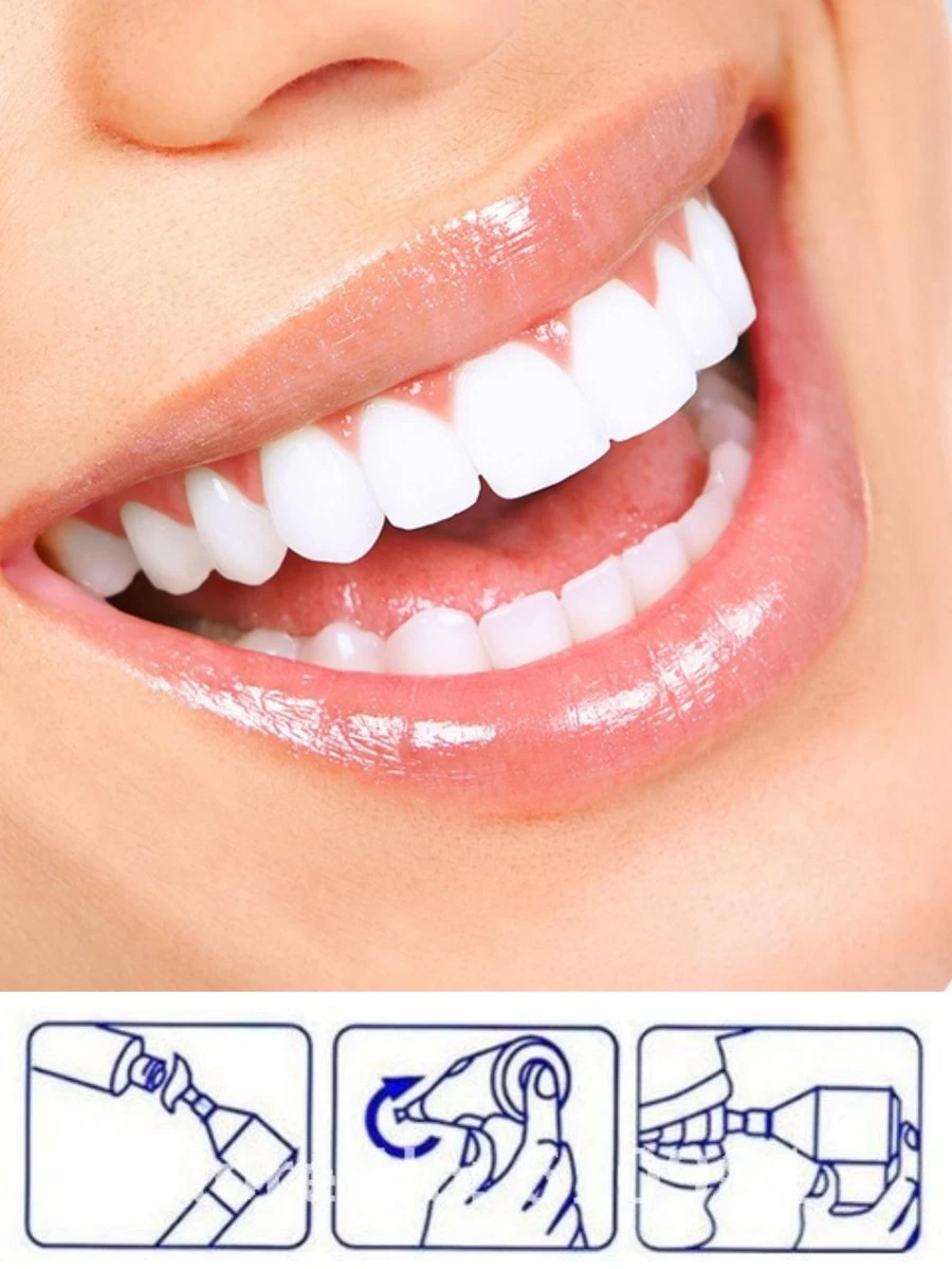 Merkloos HQ Tooth Polisher - Tanden Polijsten - Wittere Tanden - Tandsteen Tandplak Verwijderaar - Elektrisch - Afbeelding 3